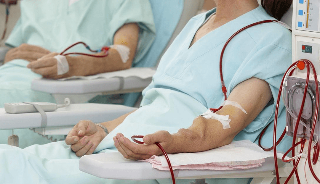 Arterio Venous Fistula ( AVF )