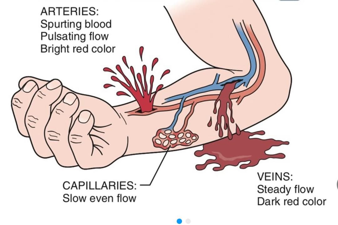 Vascular Injuries