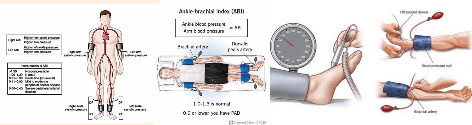 Open RFA or Laser Based Varicose Vein Treatments Page