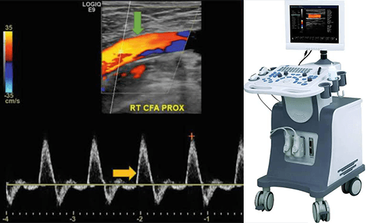 Duplex ultrasound scanning for vascular assessment