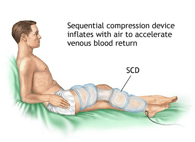 DVT Example 4